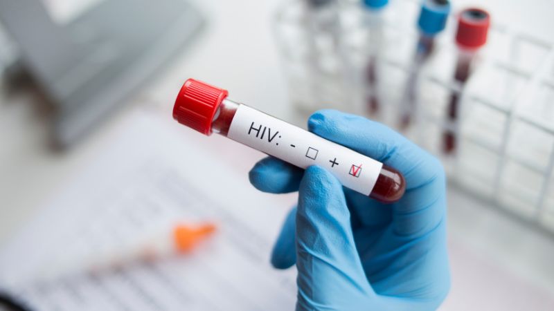 Cần làm gì khi phơi nhiễm HIV?