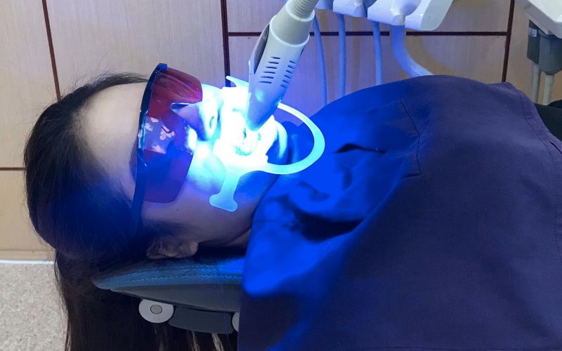 Tẩy trắng răng bằng đèn Plasma không gây hại cho sức khỏe người dùng