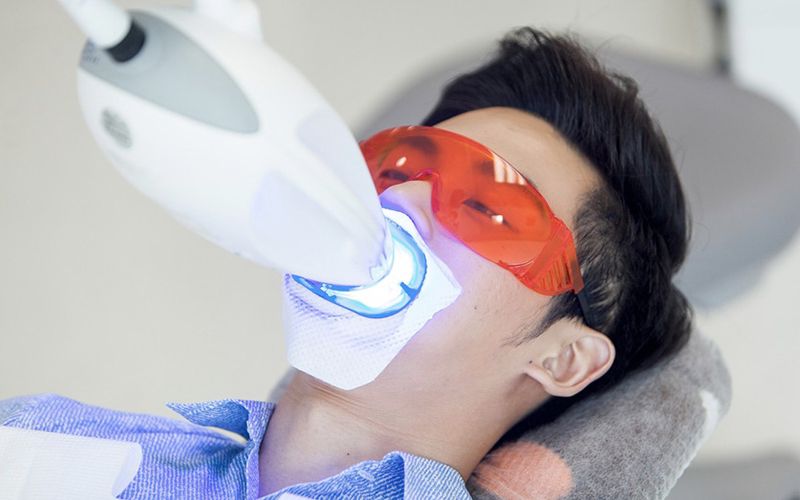 Nên tẩy trắng răng bằng đèn Plasma ở cơ sở nha khoa uy tín