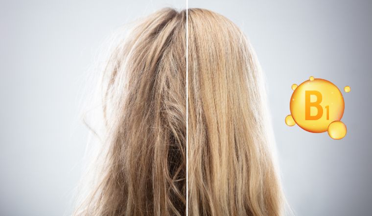 Chữa rụng tóc bằng vitamin B1 có thực sự hiệu quả không? 