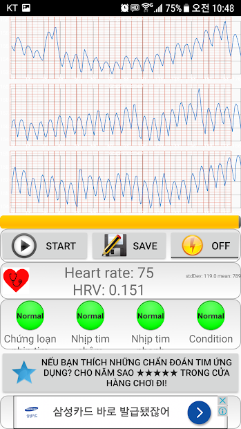Screenshots Chẩn đoán tim (loạn nhịp tim): Đo nhịp tim bằng camera