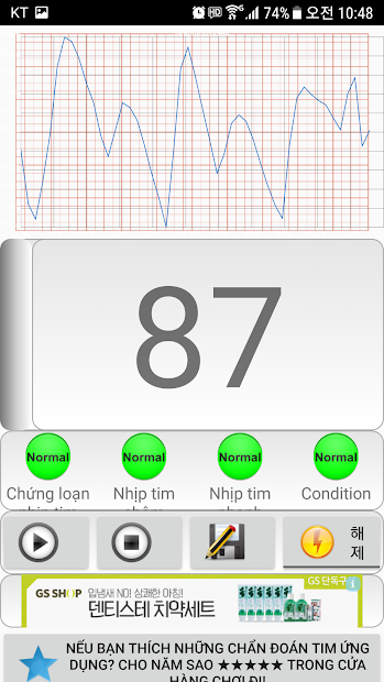 Screenshots Chẩn đoán tim (loạn nhịp tim): Đo nhịp tim bằng camera