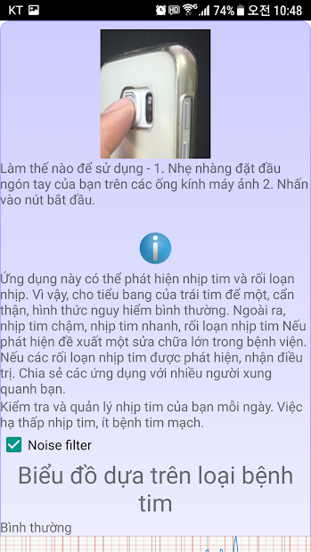 Screenshots Chẩn đoán tim (loạn nhịp tim): Đo nhịp tim bằng camera