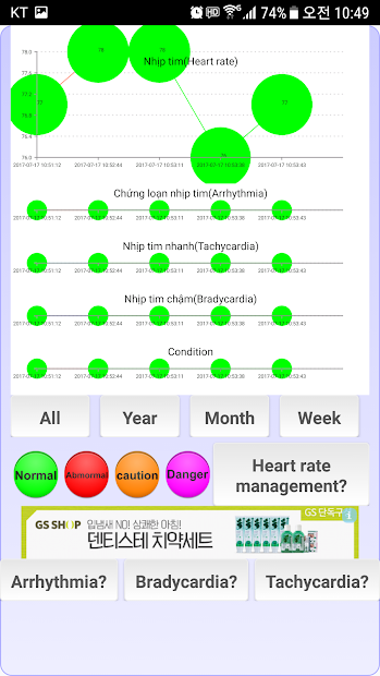 Screenshots Chẩn đoán tim (loạn nhịp tim): Đo nhịp tim bằng camera