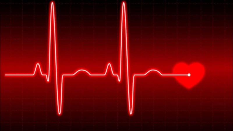 Hội chứng Eisenmenger có thể gây loạn nhịp tim