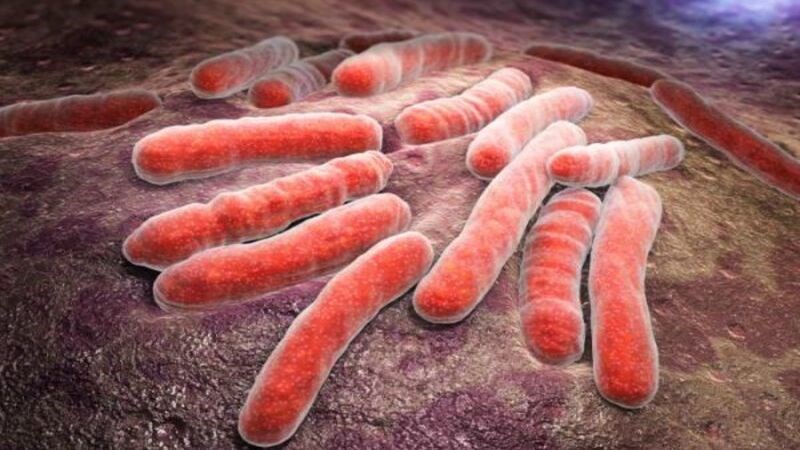 Lao hệ tiết niệu sinh dục do vi khuẩn Mycobacterium tuberculosis gây ra