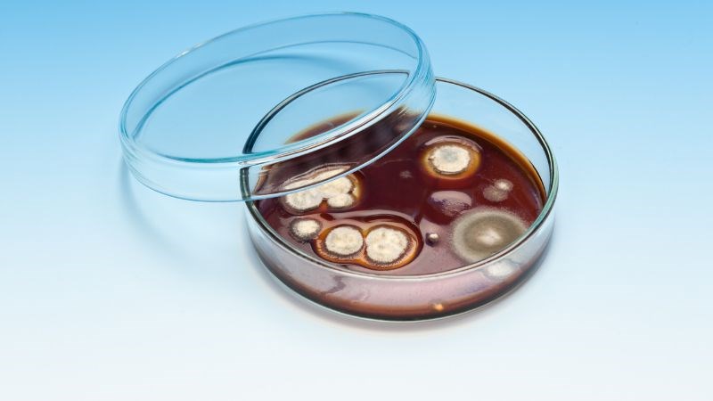 Nuôi cấy nấm giúp xác định chủng loại nấm mà người bệnh mắc phải Nuôi cấy nấm giúp xác định chủng loại nấm mà người bệnh mắc phải