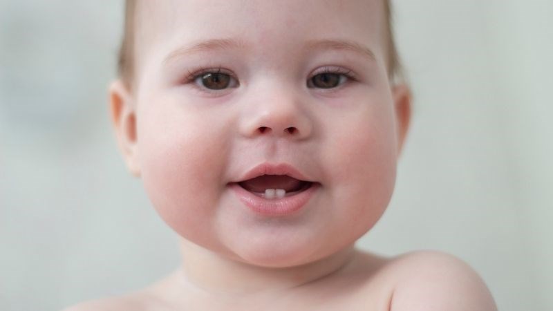Má ửng hồng là một dấu hiệu điển hình của việc trẻ mọc răng