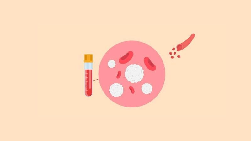 Ung thư máu là bệnh do sự tăng sinh bất thường của tế bào máu