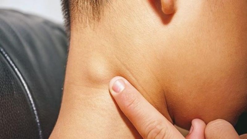 Bệnh nhân ung thư máu có thể phát hiện thấy hạch to 