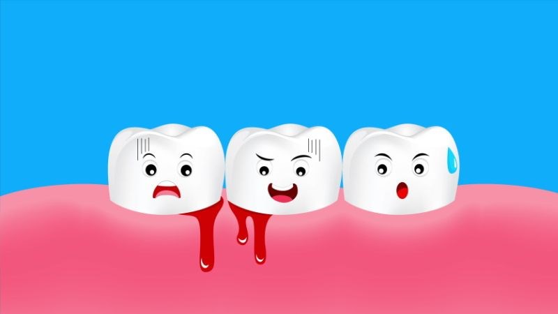 Chảy máu chân răng thường xuyên là dấu hiệu cần gặp bác sĩ