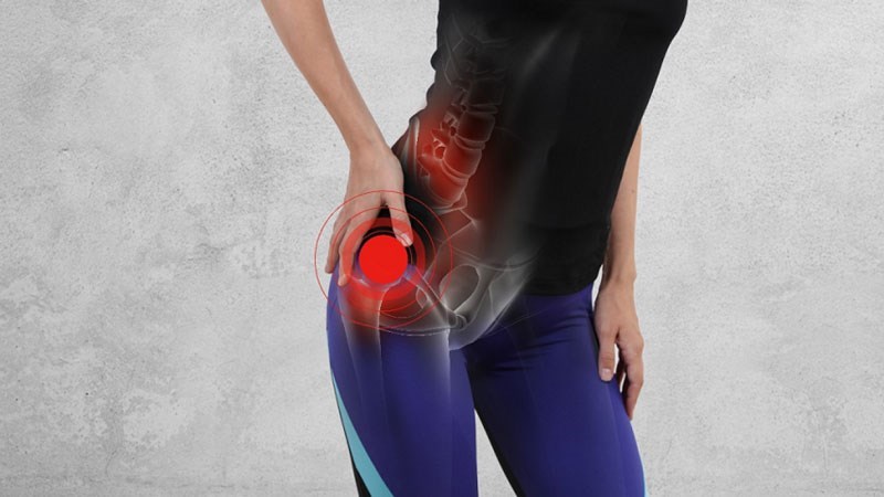 Thần kinh tọa bị chèn ép có thể gây ra đau thắt lưng