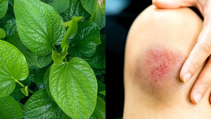 Dùng lá trầu không đắp lên vết thương giúp mau lành