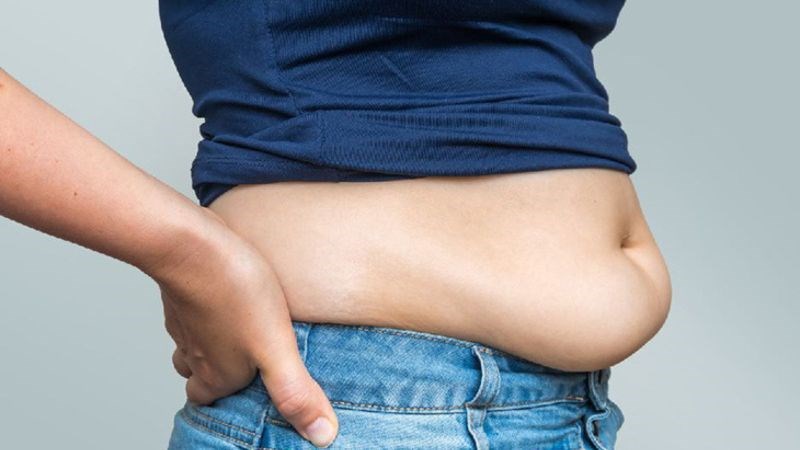 Người béo phì có tỷ lệ mắc sỏi thận cao hơn