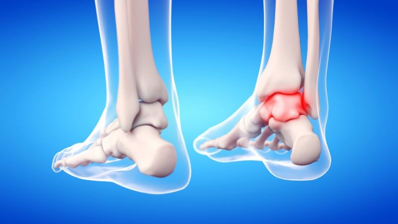 Collagen loại II giúp kích thích sự phát triển của sụn