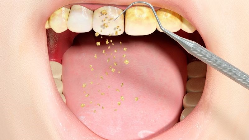 Cây xô thơm có tác dụng kháng khuẩn giúp tiêu diệt các mảng bám