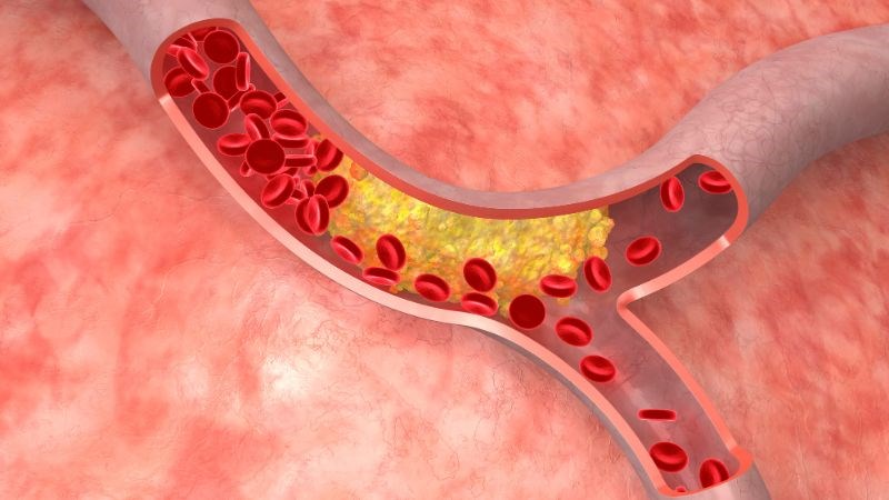 Xô thơm có thể làm giảm cholesterol xấu tích tụ trong động mạch