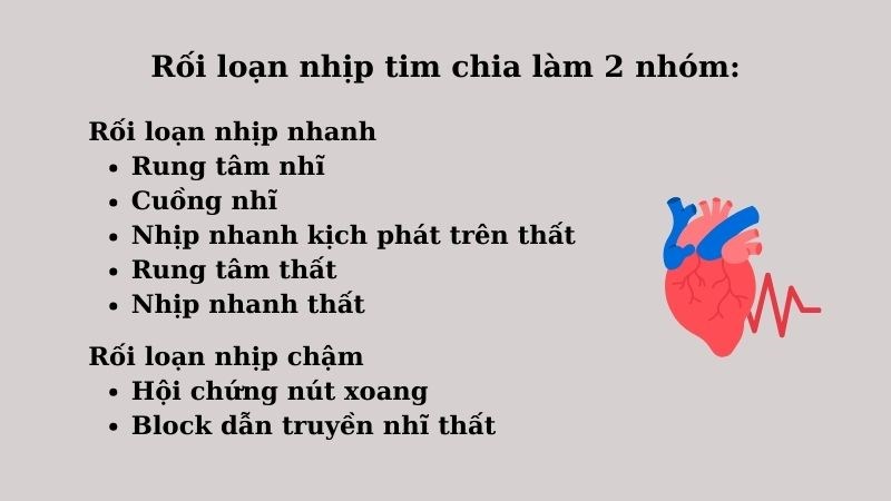 Rối loạn nhịp tim chia làm 2 nhóm: rối loạn nhịp nhanh và rối loạn nhịp chậm