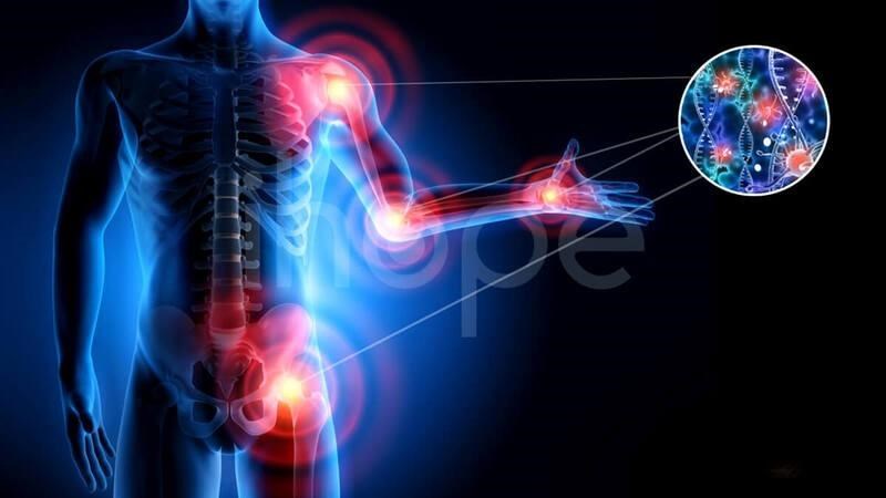 Sarcoma mô mềm có thể xảy ra ở bất kỳ vị trí nào trên cơ thể