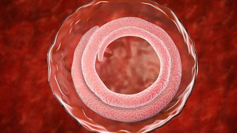 Giun xoắn là loại ký sinh trùng gây bệnh đường tiêu hóa 