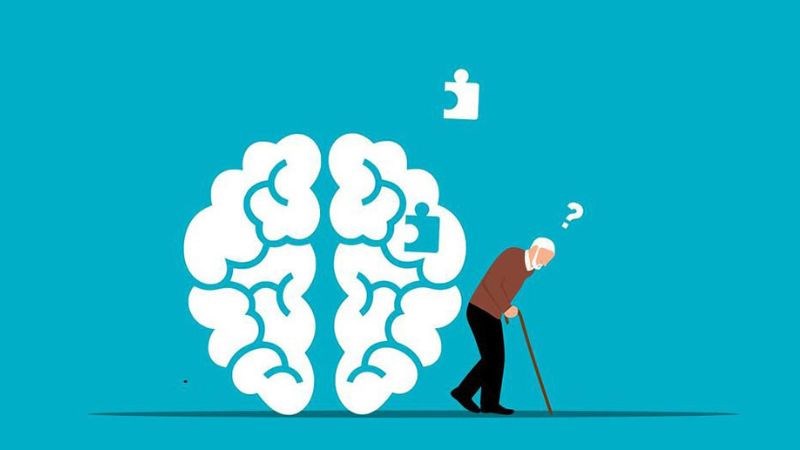 Alzheimer có thể là bệnh lý gây ra teo não