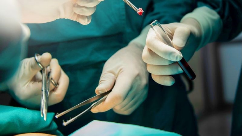 Bác sĩ có thể tiến hành sinh thiết khối u để chẩn đoán u mỡ