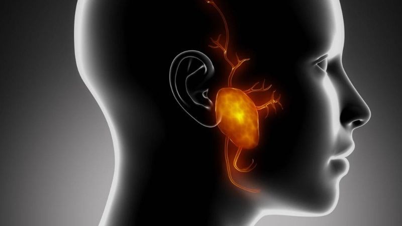 Sưng đau vùng trước tai có thể là dấu hiệu của ung thư tuyến nước bọt Sưng đau vùng trước tai có thể là dấu hiệu của ung thư tuyến nước bọt