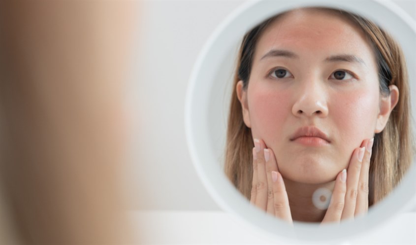 Thời tiết hanh khô khiến làn da mất nước trầm trọng