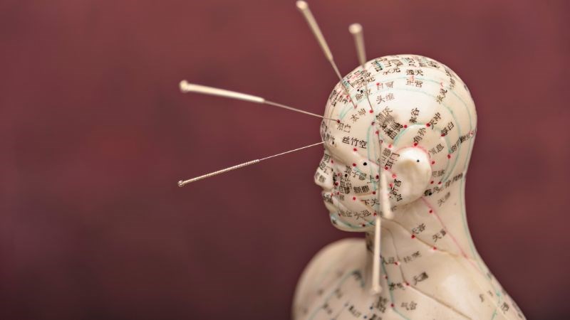 Người thực hiện phương pháp cấy chỉ phải có kiến thức sâu rộng về các huyệt vị trên cơ thể