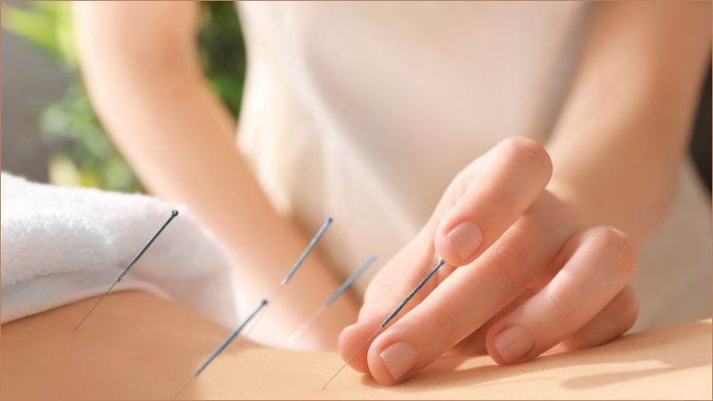 Sau khi cấy chỉ, người bệnh cần nằm nghỉ ngơi, thư giãn và tránh vận động mạnh