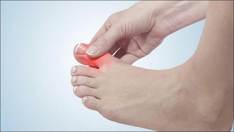Cây mật gấu có chứa flavonoid giúp hỗ trợ điều trị gút