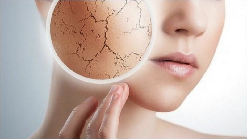 Mặt nạ chuối giúp da trở nên tươi đẹp và căng bóng hơn