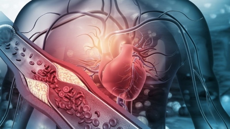 Hàm lượng pectin trong chuối tiêu làm giảm cholesterol xấu trong máu