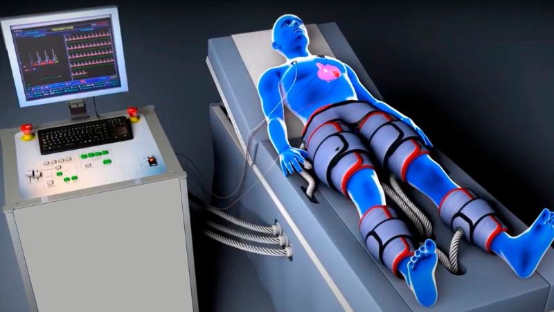Liệu pháp EECP có thể điều trị cơn đau thắt ngực