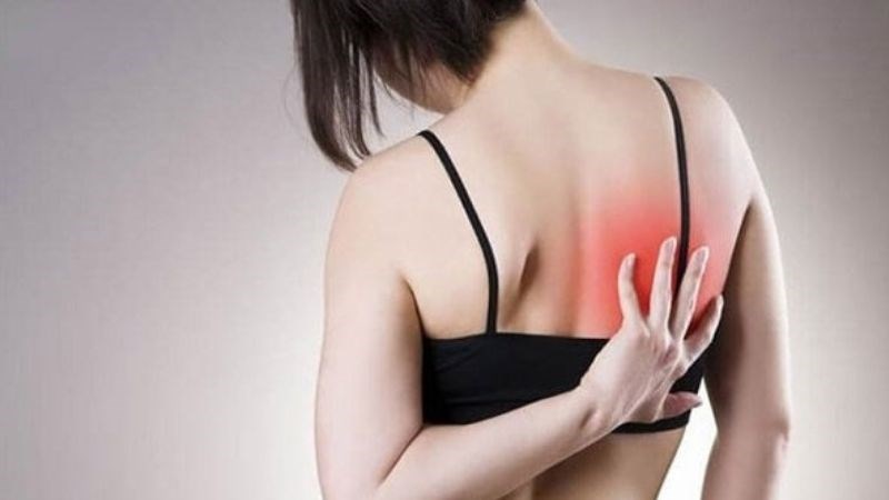 Đau nhói lưng trên có thể gặp do tổn thương cơ