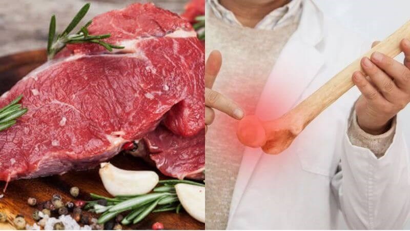 Những người bị đau xương khớp không nên ăn thịt bò