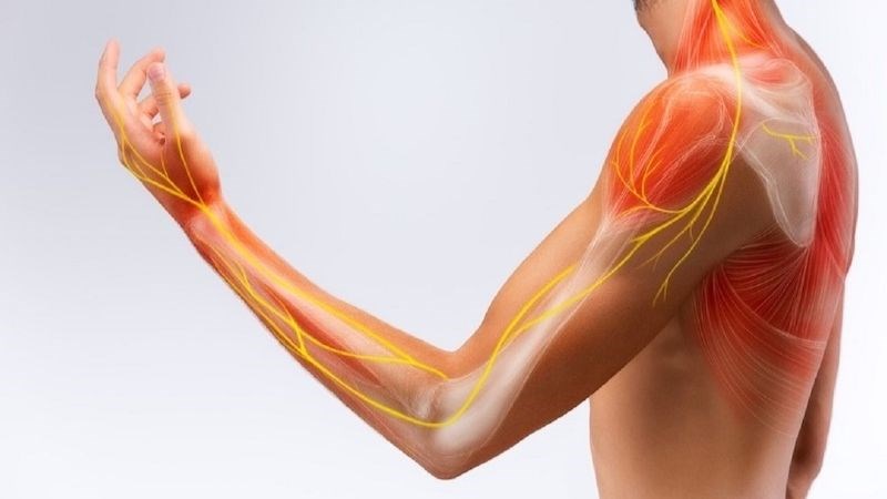 Dị cảm mạn tính có thể gặp do tổn thương thần kinh