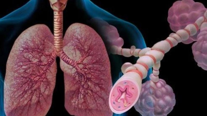 Hen suyễn gây co thắt phế quản và dẫn đến ho khan Hen suyễn gây co thắt phế quản và dẫn đến ho khan