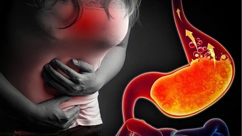 Sự kích thích của axit dạ dày lên vùng hầu họng có thể dẫn đến ho khan Sự kích thích của axit dạ dày lên vùng hầu họng có thể dẫn đến ho khan
