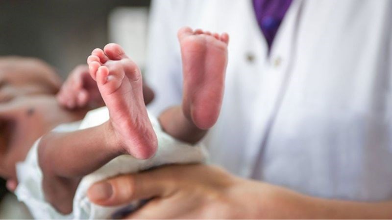 Trẻ mắc hội chứng Edward có thể xuất hiện bàn chân khoèo Trẻ mắc hội chứng Edward có thể xuất hiện bàn chân khoèo