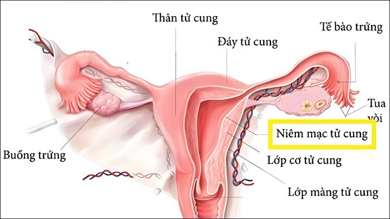 Niêm mạc tử cung mỏng kiêng ăn gì? Khám phá chế độ dinh dưỡng tối ưu cho sức khỏe