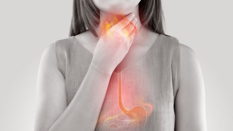 Trào ngược axit có thể gây nóng rát dạ dày và sau xương ức