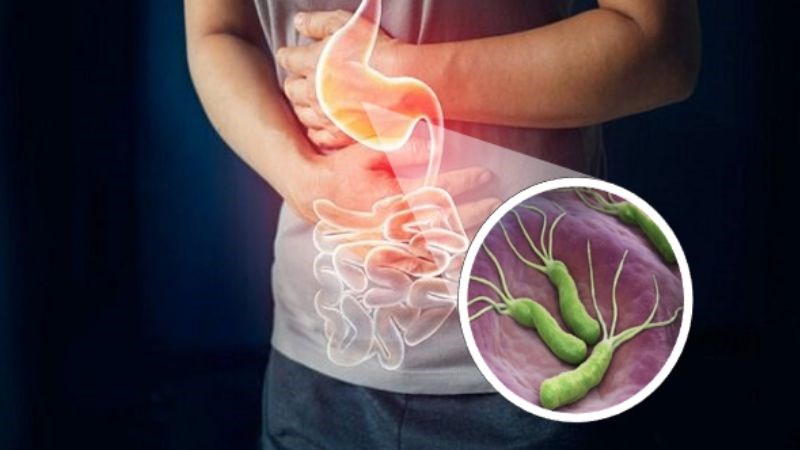 Nóng rát dạ dày là triệu chứng có thể gặp ở người nhiễm vi khuẩn HP