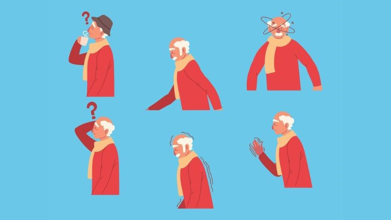 Parkinson là bệnh thoái hóa thần kinh gây ra run cơ và một số dấu hiệu khác Parkinson là bệnh thoái hóa thần kinh gây ra run cơ và một số dấu hiệu khác