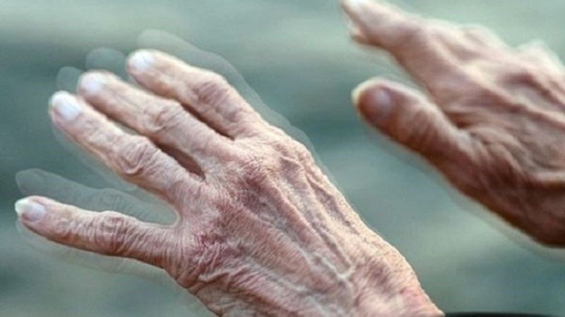 Run rẩy tay chân là dấu hiệu thường gặp của bệnh Parkinson Run rẩy tay chân là dấu hiệu thường gặp của bệnh Parkinson
