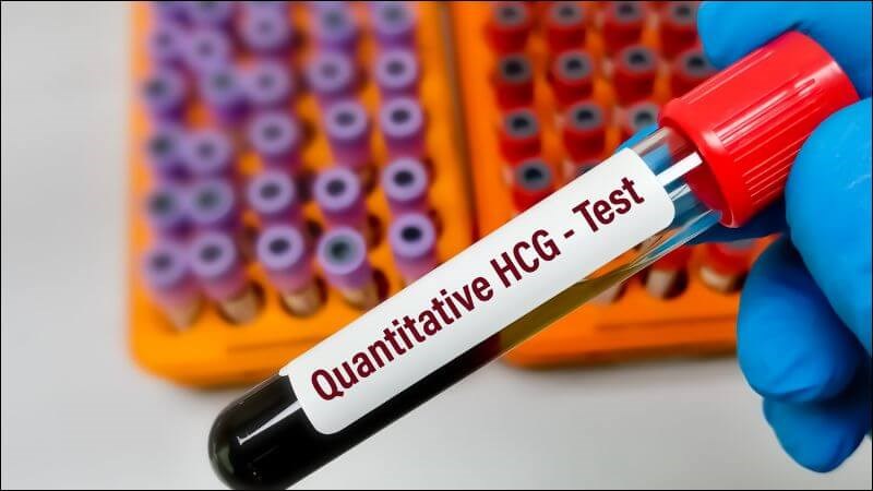 Nồng độ HCG thấp là một trong những nguyên nhân dẫn đến hiện tượng có thai nhưng thử que 1 vạch