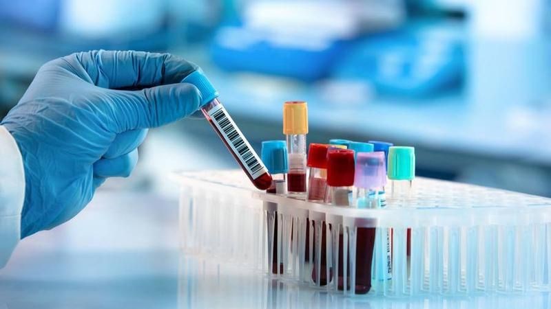 Xét nghiệm sinh hóa máu và định lượng kháng thể sẽ giúp chẩn đoán viêm gan tự miễn Xét nghiệm sinh hóa máu và định lượng kháng thể sẽ giúp chẩn đoán viêm gan tự miễn