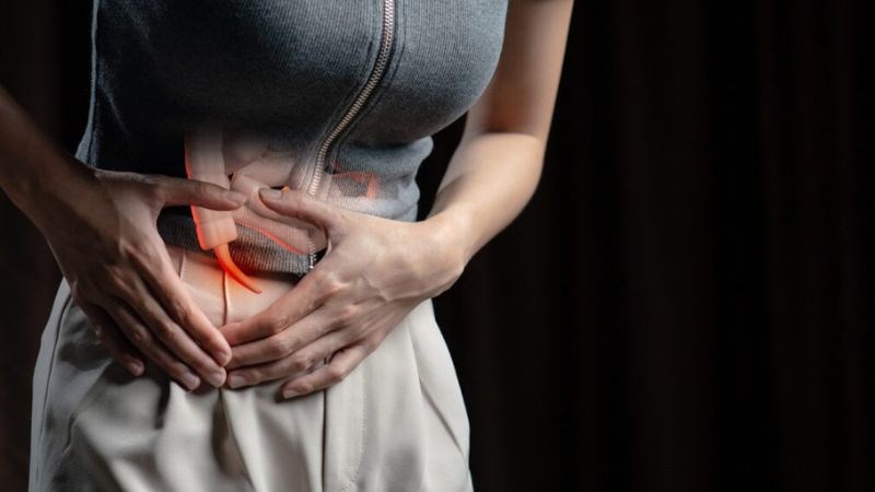 Viêm ruột thừa điển hình nằm ở bụng dưới bên phải