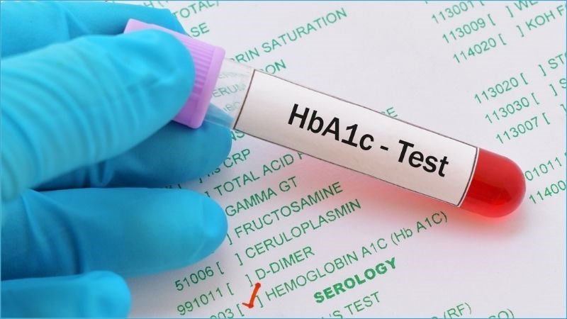 Xét nghiệm HbA1c cho biết mức glucose huyết trung bình trong hai đến ba tháng