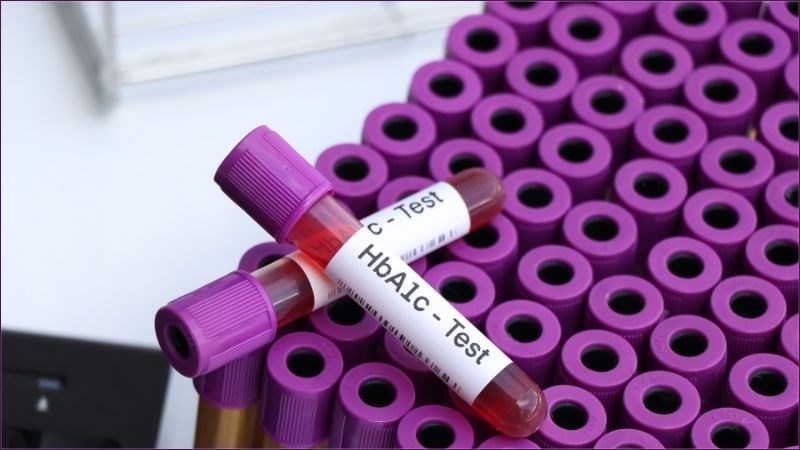 Xét nghiệm HbA1c ít bị ảnh hưởng bởi những thay đổi ngắn hạn như ăn uống hay tập thể dục